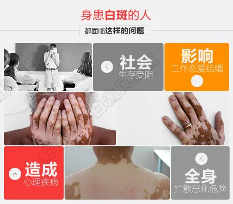 成都最好的白癜风医院是哪家
